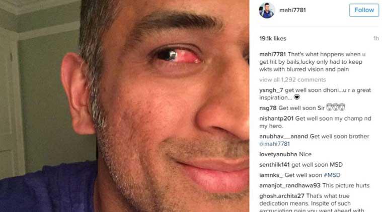 Mahendra Singh Dhoni Lucky To Survive Freak Accident Against Zimbabwe