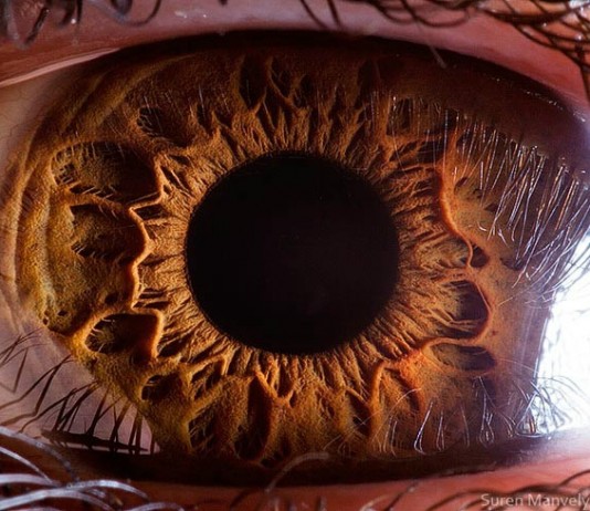 10 Things That Look Absolutely Bizarre Under a Microscope – Mind Blowing Images