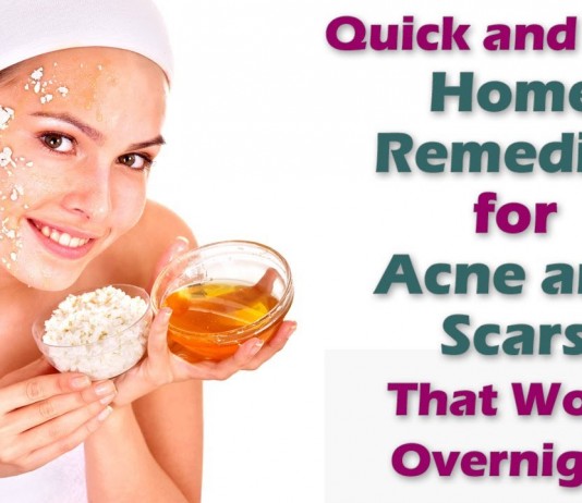 Get rid of pimples in one week by 4 effective home remedies