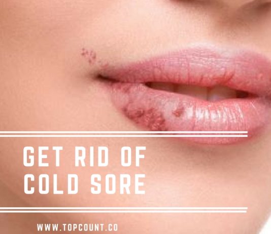 Get Rid of Cold Sores With These Simple Home Remedies