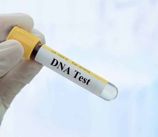 5 Most Common Uses of DNA Tests