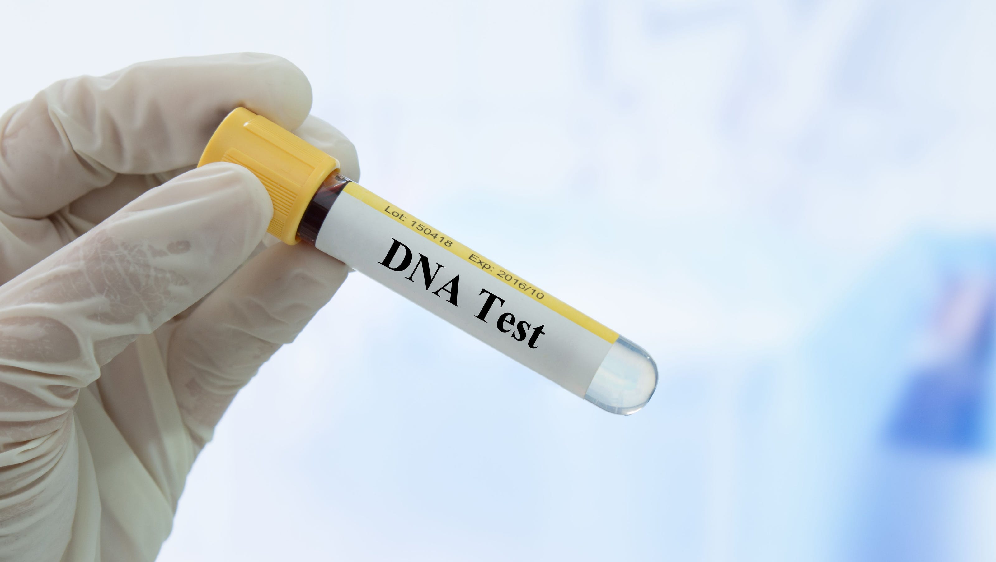 5 Most Common Uses of DNA Tests
